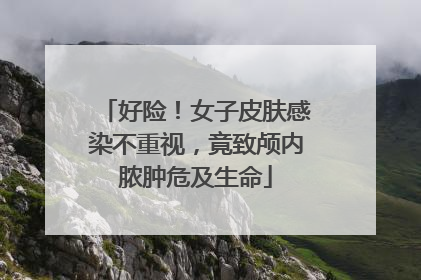好险！女子皮肤感染不重视，竟致颅内脓肿危及生命
